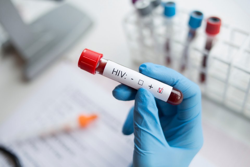 AIDS Nedir? HIV Nedir? AIDS Nasıl Tedavi Edilir?