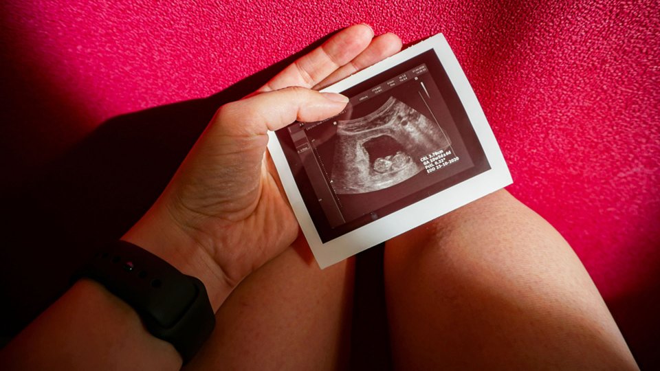 10 Haftalık Gebelik