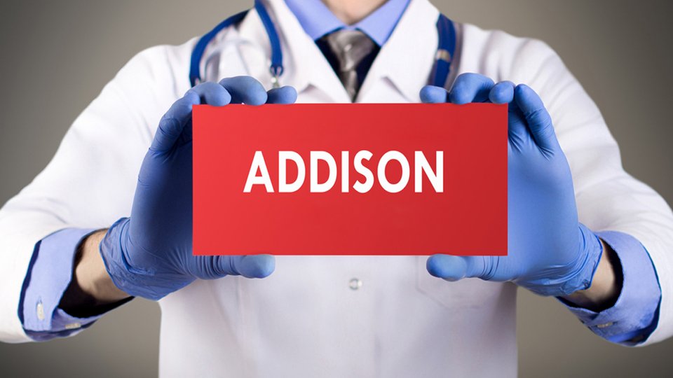 Addison Hastalığı Nedir? Nasıl Tedavi Edilir?