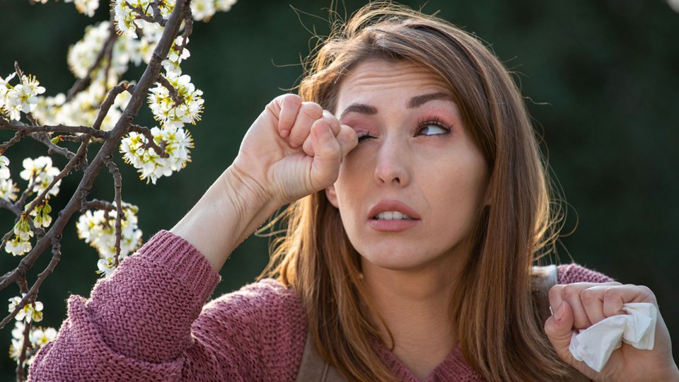 Alerjik Konjonktivit (Alerjik Pembe Göz) Nedir?