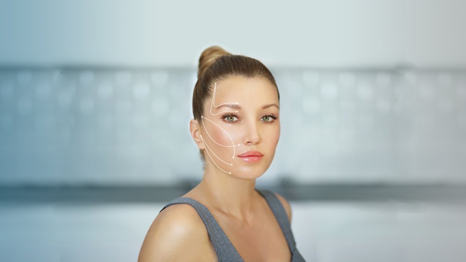Ameliyatsız Yüz Germe (İple Yüz Germe) Nedir?