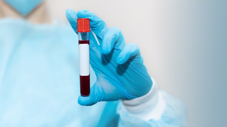 Amilaz Nedir? Amilaz Testi Neden Yaptırılır?