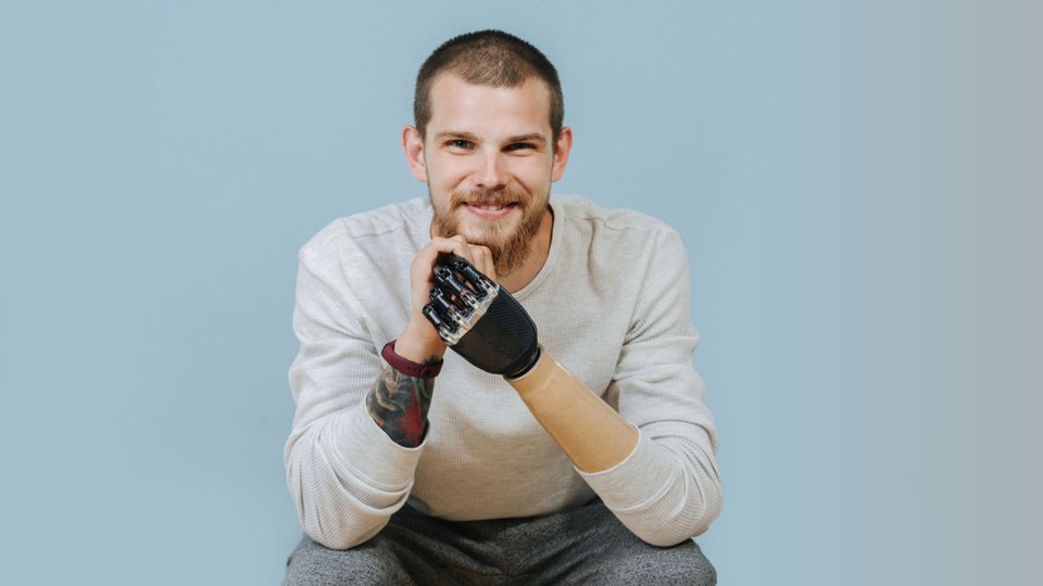 Ampütasyon Nedir? Belirtileri ve Süreci