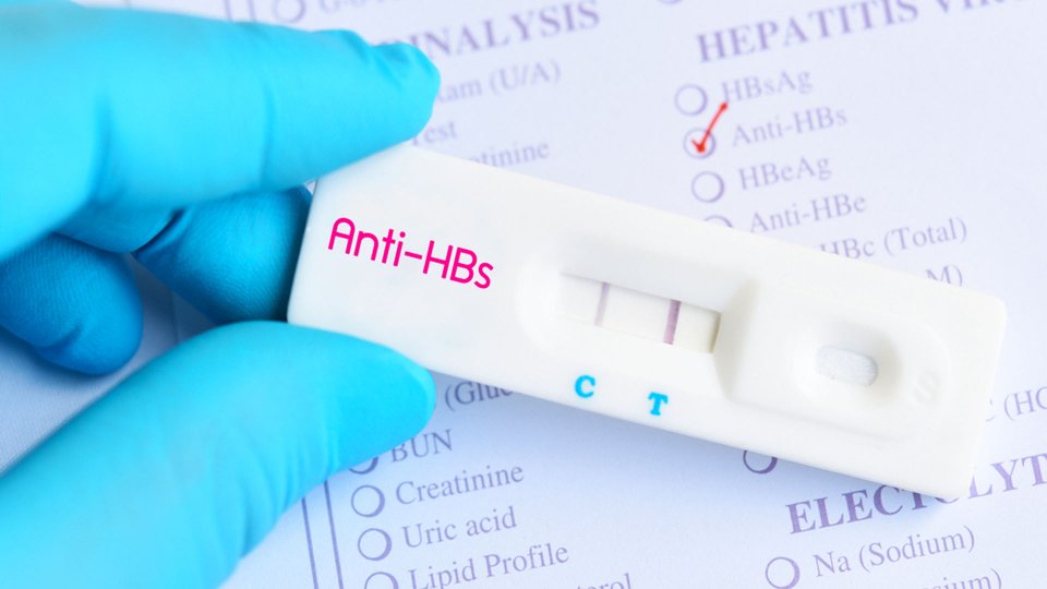 Anti HBs Nedir? - Büyük Anadolu Hastanesi