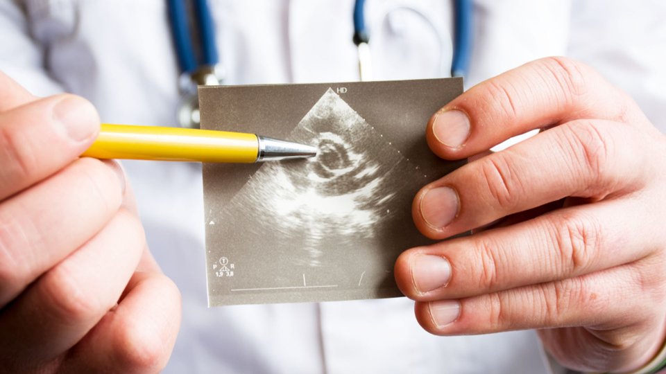 Aort Kapak Darlığı Nedir? Belirtileri ve Tedavisi