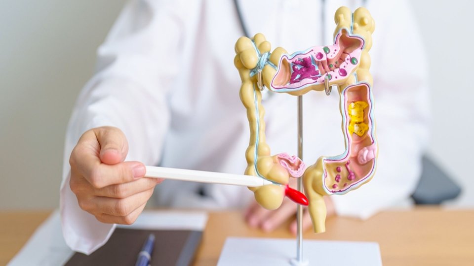 Apandisit Ameliyatı Nasıl Yapılır?