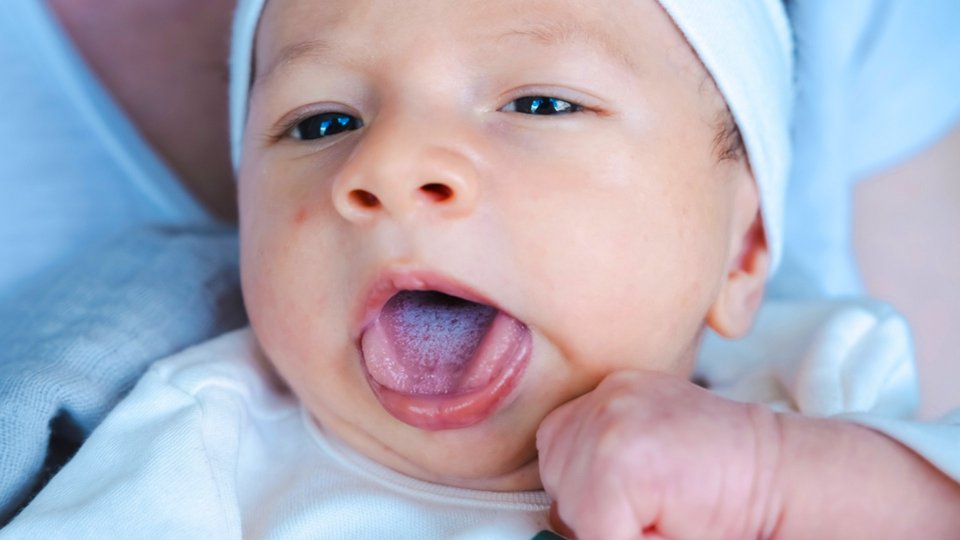 Bebeklerde Pamukçuk Nedir? Nasıl Geçer?