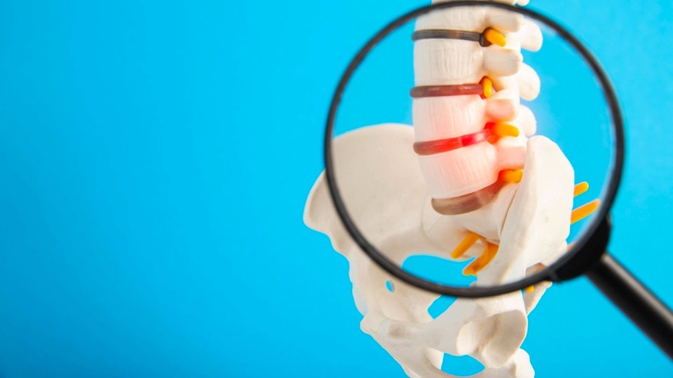 Bel Kayması Nedir? Belirtileri ve Tedavisi