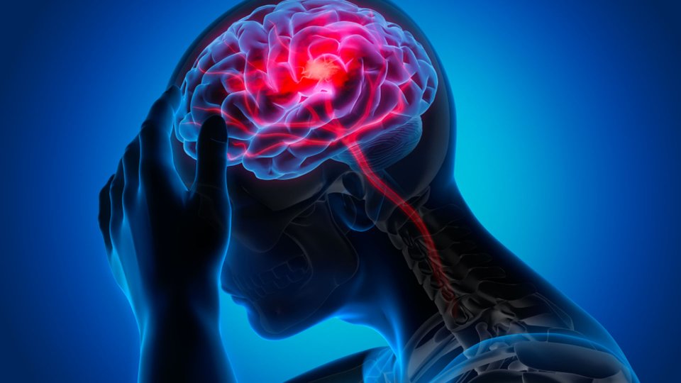 Beyin Kanamasının Nedenleri