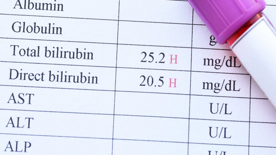 Bilirubin Nedir? Ne İşe Yarar?