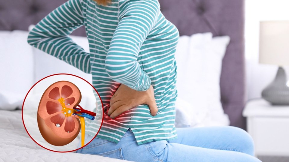 Böbrek Ağrısı Nedir? Böbrek Ağrısına Ne İyi Gelir?