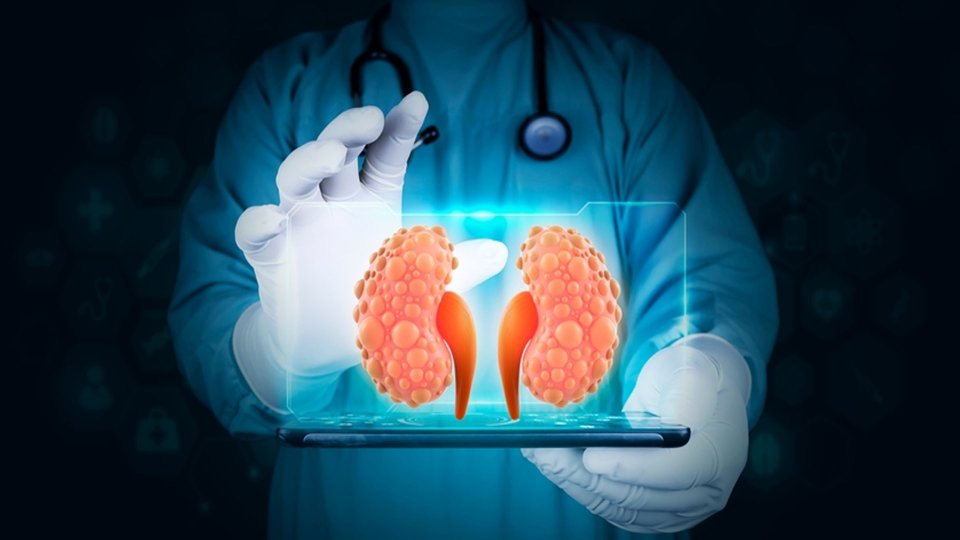 Böbrek Kistleri Neden Oluşur? Üriner Sisteme Etkileri Nelerdir?