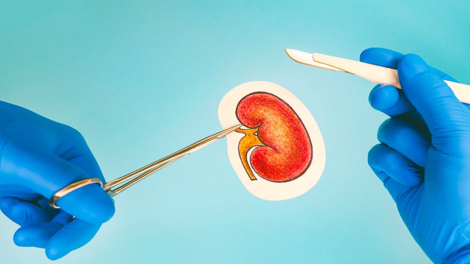 ‎Böbrek Nakli Nedir? Böbrek Nakli Nasıl Yapılır? 