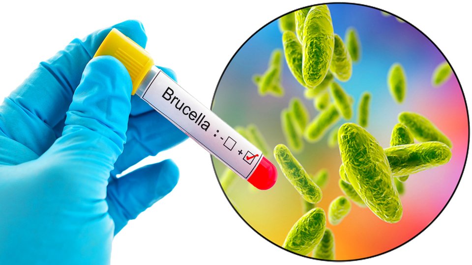 İnsanlarda Sık Görülen Zoonoz Hastalıklardan Biri: Brusella Nedir?