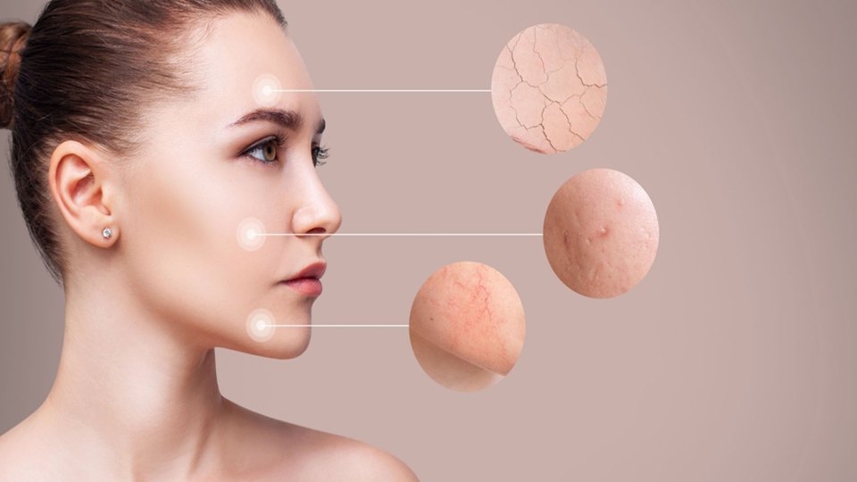 Büyük Anadolu Hastaneleri'nden 'Cilt Kuruluğu' Uyarısı