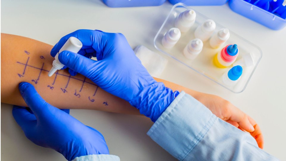 Deri Prick Testi Nedir? 