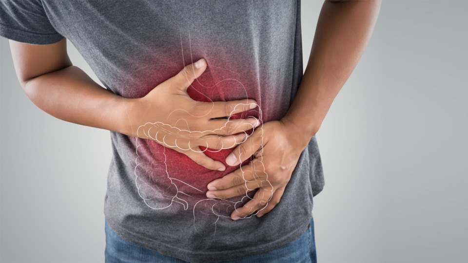 Dev Mide Fıtığı (Hiatal Herni)