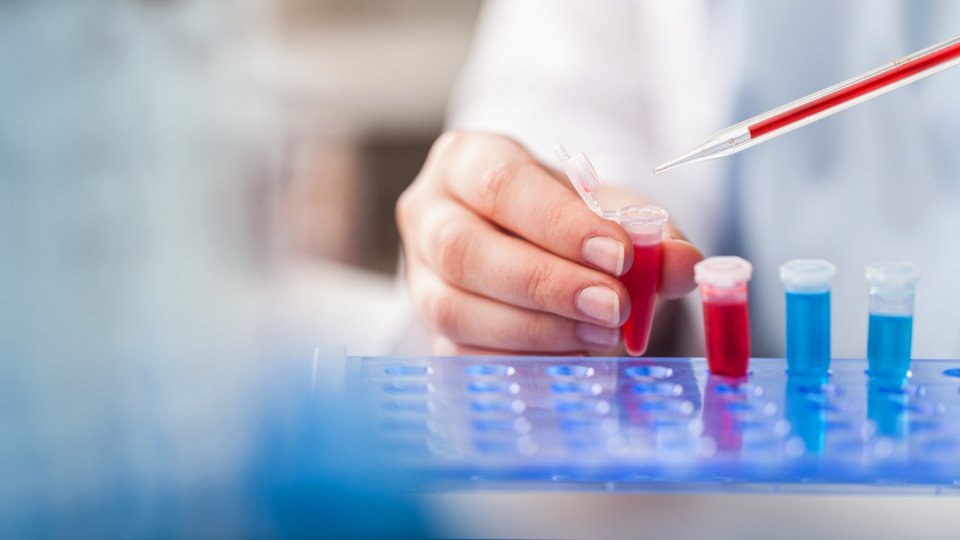 Elisa Testi Nedir? Nasıl Uygulanır?
