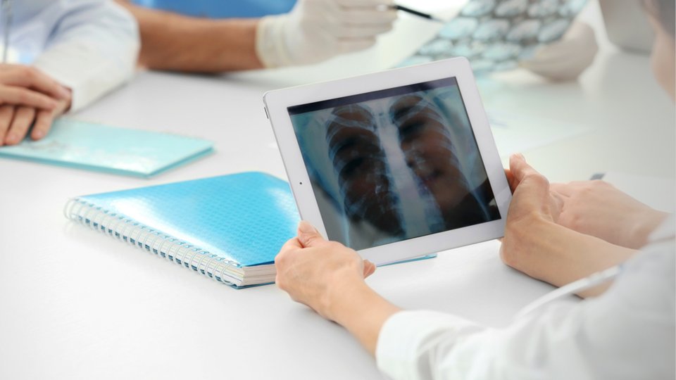 Endobronşiyal Ultrasonografi (EBUS) Nedir?