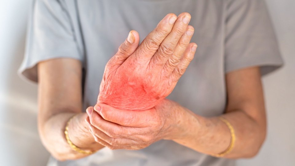 Erişkin Still Hastalığı Nedir? Belirtileri, Nedenleri ve Tedavisi