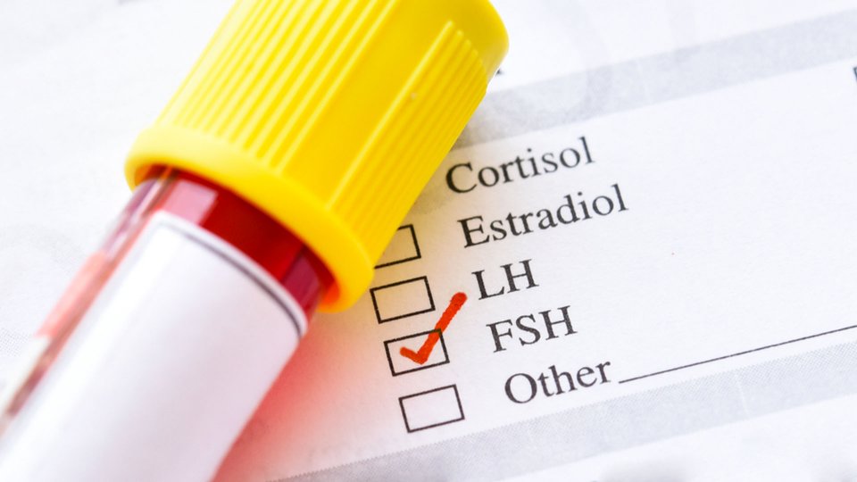FSH Nedir? FSH Hormonu Kaç Olmalıdır? FSH Yüksekliği ve Düşüklüğü