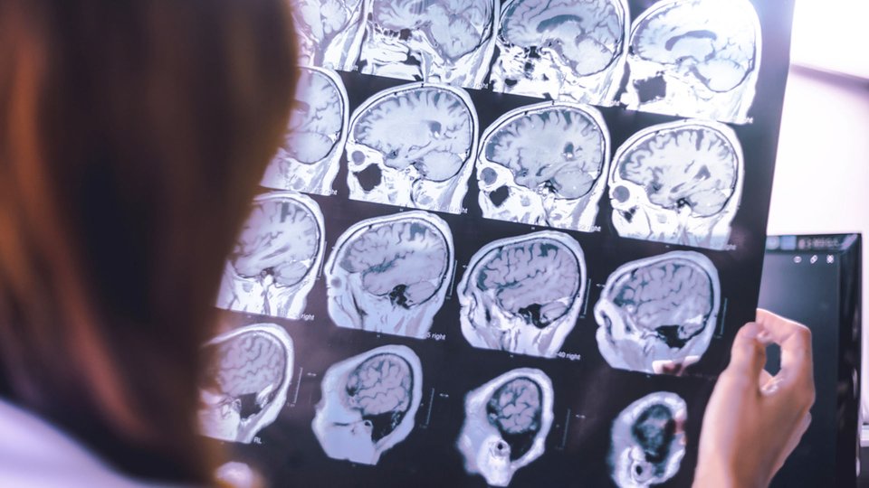 Frontotemporal Demans Nedir? Belirtileri Nelerdir?