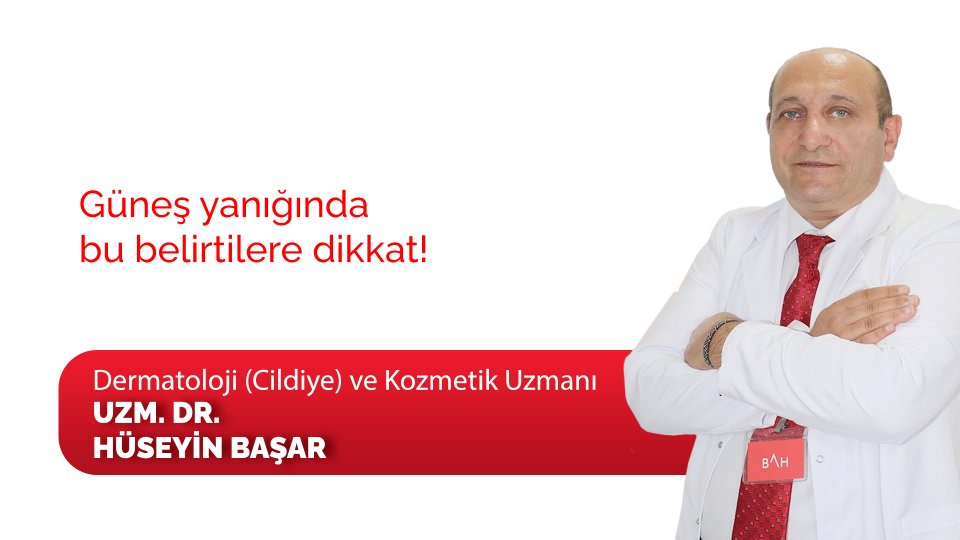 Güneş yanığında bu belirtilere dikkat!