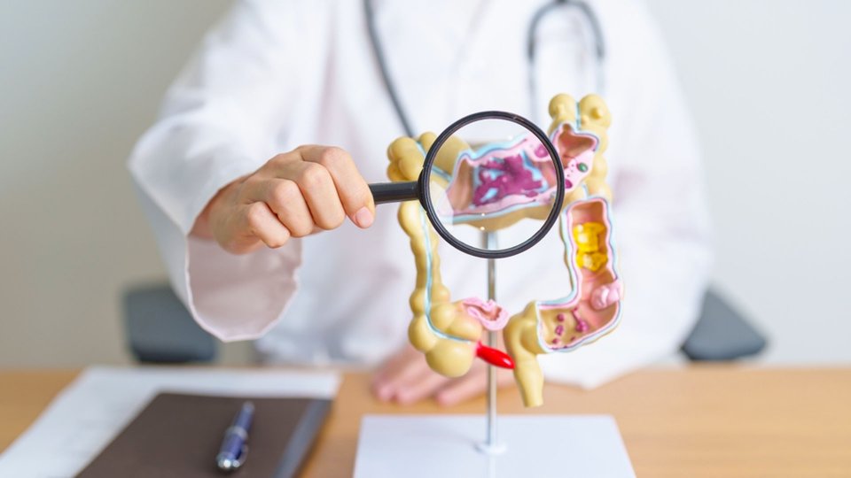 Huzursuz Bağırsak Sendromu Nedir? Belirtileri Nelerdir?