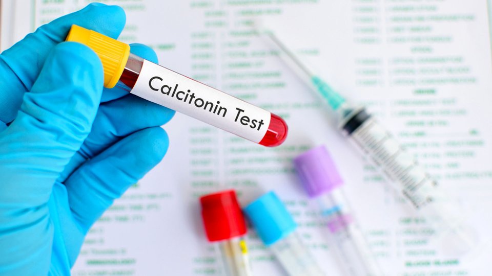 Kalsitonin Hormonu Nedir? Kalsitonin Hormonunun Görevi Nedir?