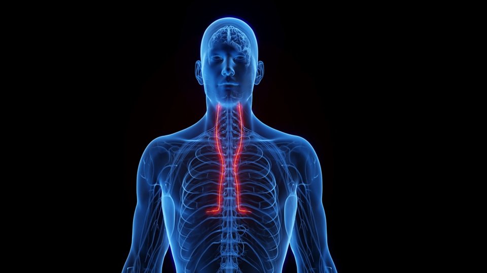 Karotis Arter (Şah Damarı) Hastalığı Nedir?