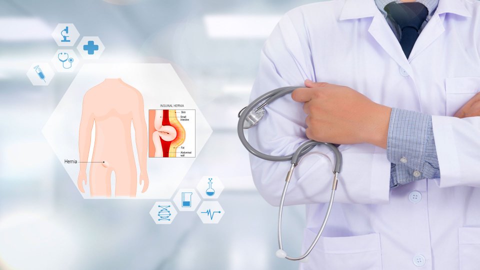 Kasık Fıtığı Nedir? Belirtileri ve Tedavisi Nedir?