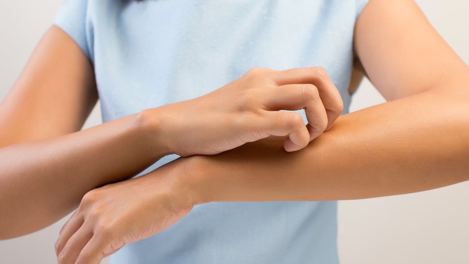 Kaşıntı Neden Olur?