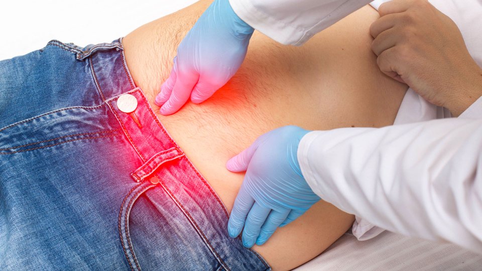 Kesi Yeri Fıtığı Cerrahisi Nedir? Nasıl Gerçekleştirilir?