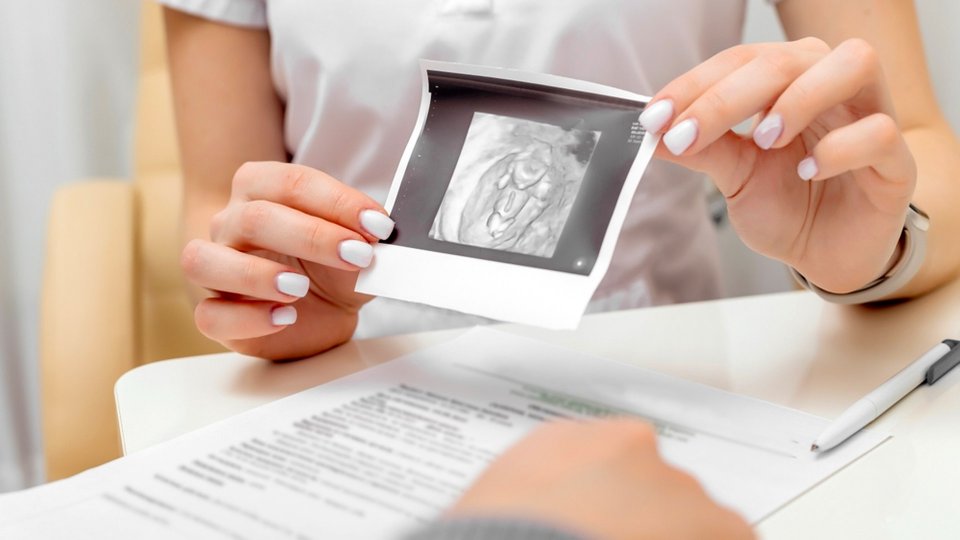 Kist Nedir? Kist Belirtileri Nelerdir?