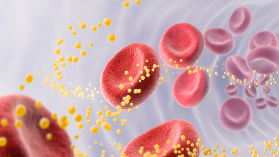 LDL Kolesterol Nedir? LDL Kolesterol Yüksekliği Nedir?