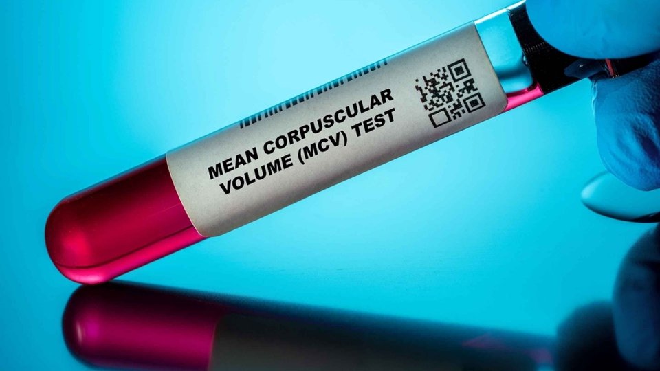 MCV Nedir? MCV Düşüklüğü ve Yüksekliği Ne Anlama Gelir?