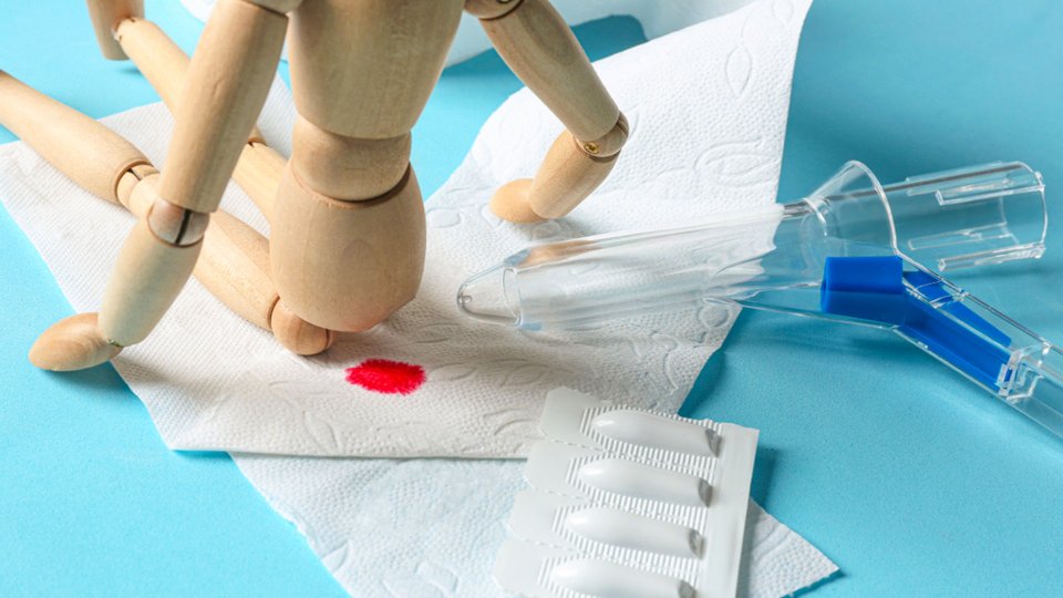 Makattan Kan Gelmesi Nedir? Makattan Kan Gelmesi Tedavisi Nedir?