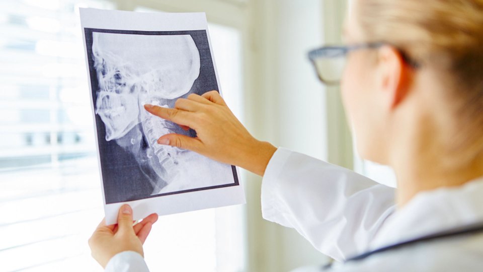 Maksillofasiyal Cerrahi Nedir?