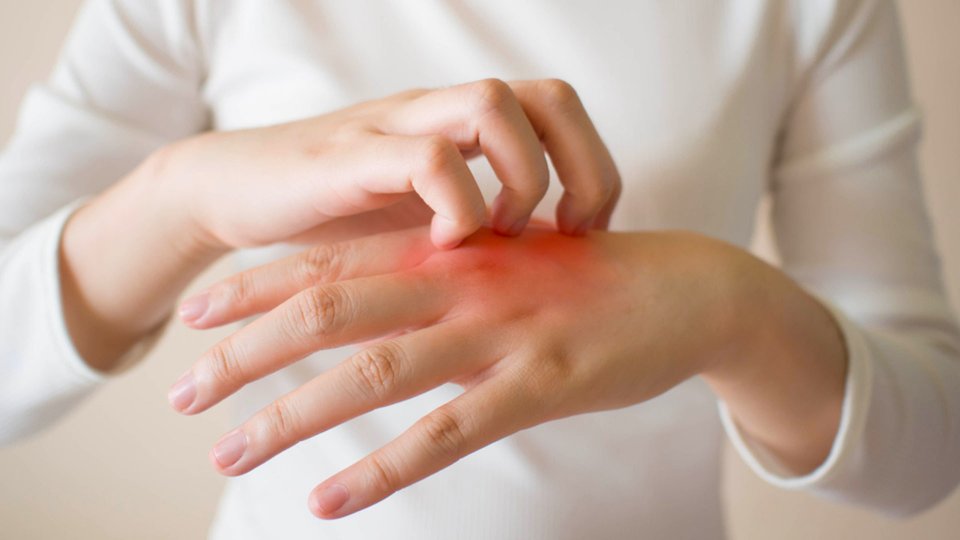 Mantar Hastalığı Nasıl Geçer?