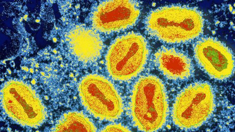 Maymun Çiçeği Virüsü: Suçiçeğinden Farkı Nedir?