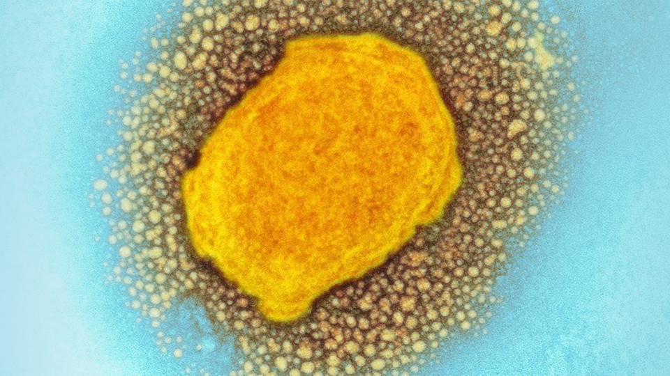 Maymun Çiçeği Virüsü Hakkında Bilmeniz Gereken 20 Şey