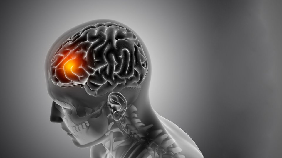 Meninjiyom Çeşitleri, Nedenleri, Belirtileri ve Tedavisi