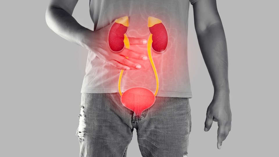 Mesane Tümörü (TUR) Biyopsisi Nedir? Nasıl Uygulanır?