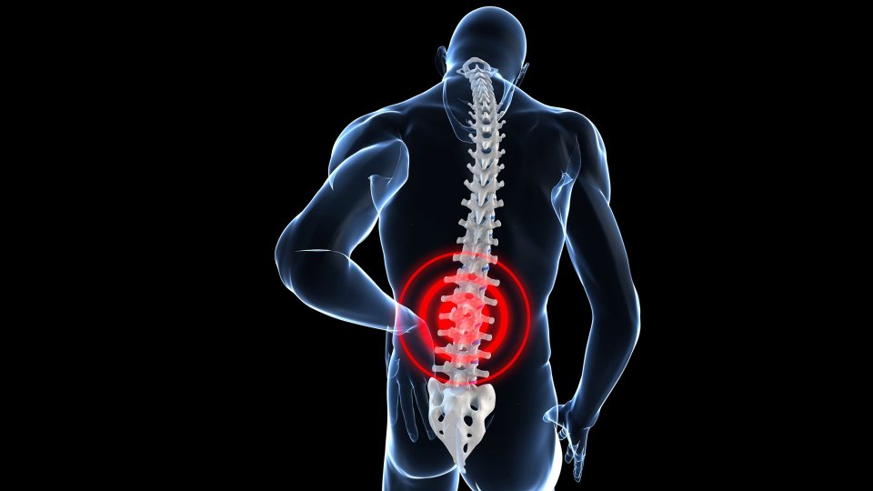 OLIF Ameliyatı Nedir? Hangi Hastalıkların Tedavisinde Kullanılır?