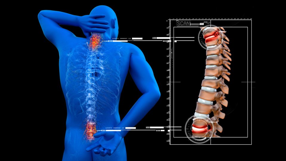 Omurga Kırığı Tedavisi Nedir? Nasıl Uygulanır?