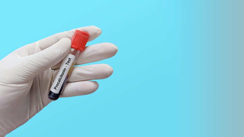 PCT Testi Nedir?