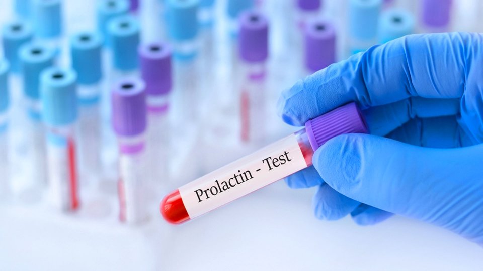Prolaktin Nedir? Prolaktin Yüksekliği Ne Anlama Gelir?