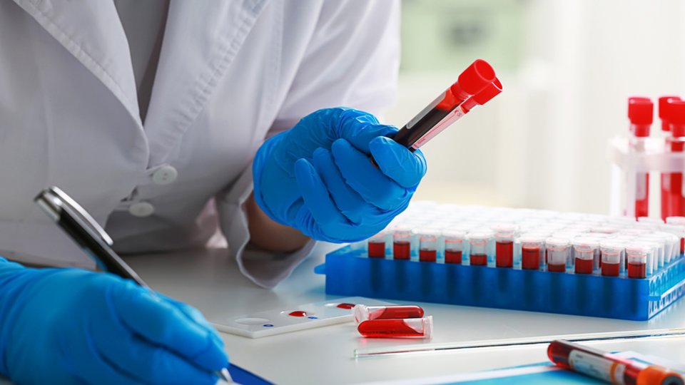 Prolaktin Testi Nedir? Hangi Hastalıkların Tanısı İçin Uygulanır?