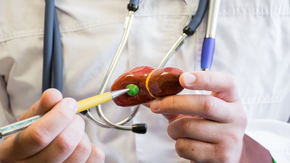 Safra Kesesi Taşı Belirtileri Nelerdir? 