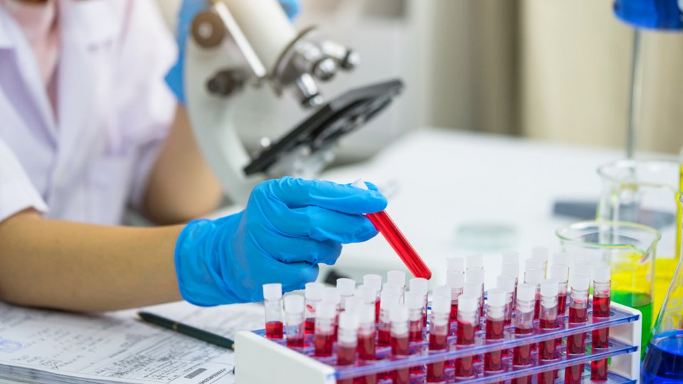 Sedimantasyon Nedir? 